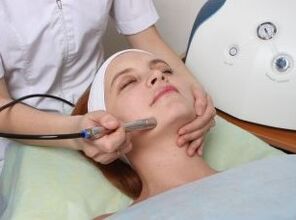 Laser rejuvenation