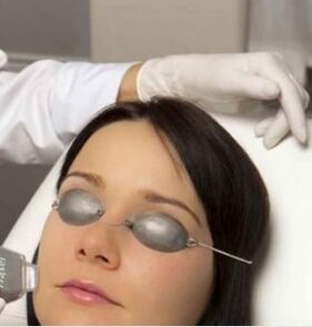 Rejuvenation with field laser