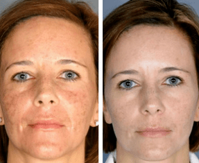The effect of the process