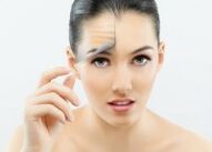 Girl after fractional laser facelift