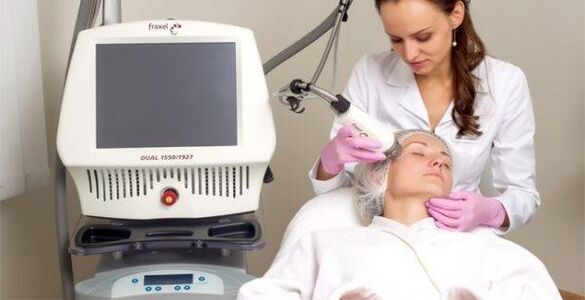 Fractional laser skin renewal