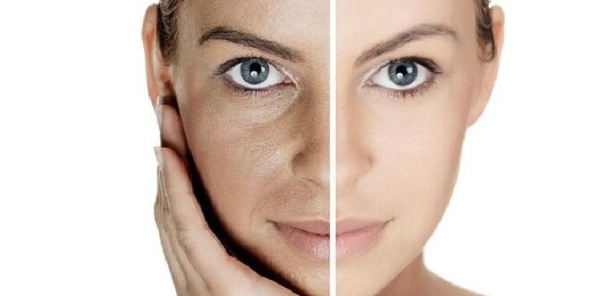 before and after facial skin renewal