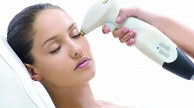 How is fractional skin renewal done