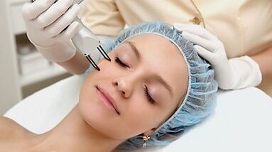 fractional facial skin renewal procedure